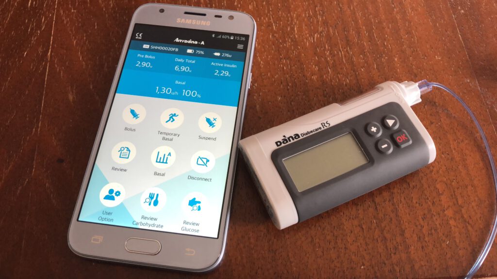 DanaRS Insulinpumpe mit dazugehöriger APP auf dem Smartphone